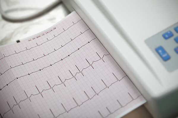 Atrial Fibrillation